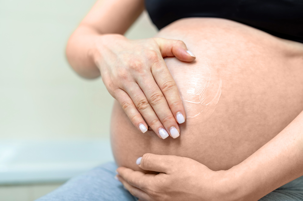 Os Pilares da Gestação Saudável: Guia Abrangente para Futuras Mães 4 Evitar estrias na gravidez 2